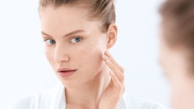 How to Use Tea Tree oil for acne? Natural Remedies, Benefits