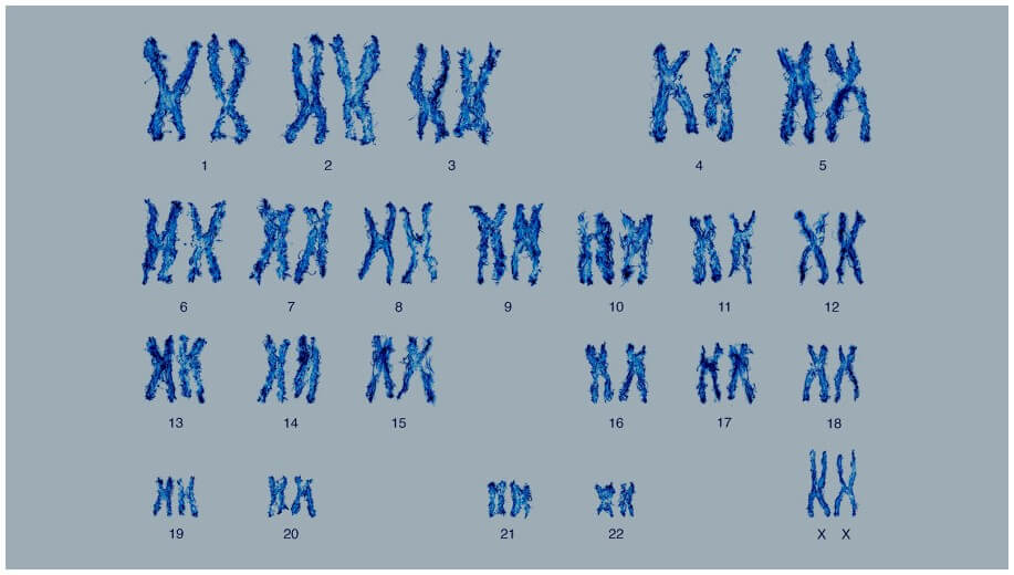 pair of chromosomes