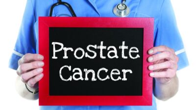 Prostate Cancer Treatment Pros and Cons You Should Know