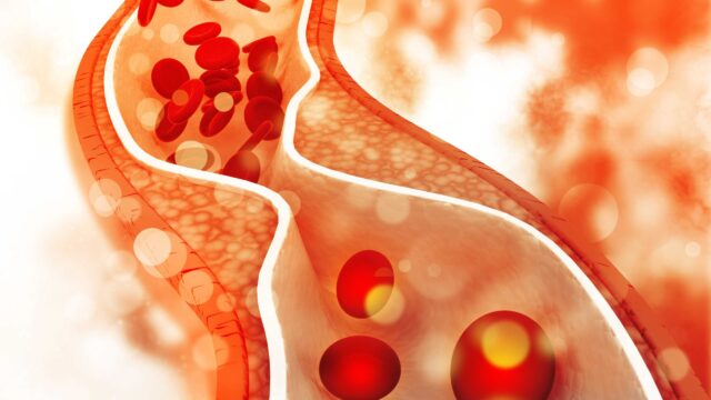 Untold True Facts About Cholesterol: Definitive Guide