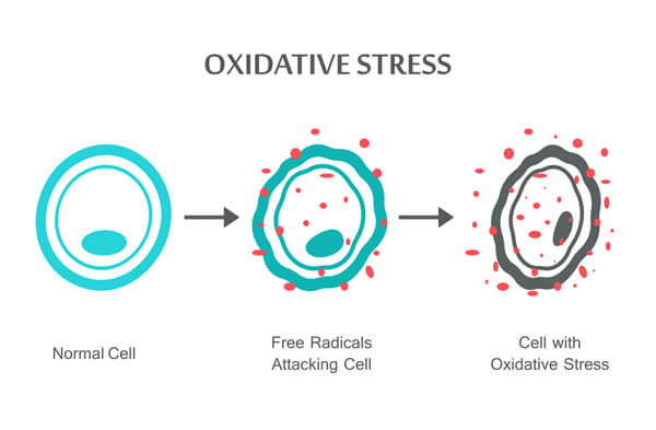 free radicals and oxidative stress