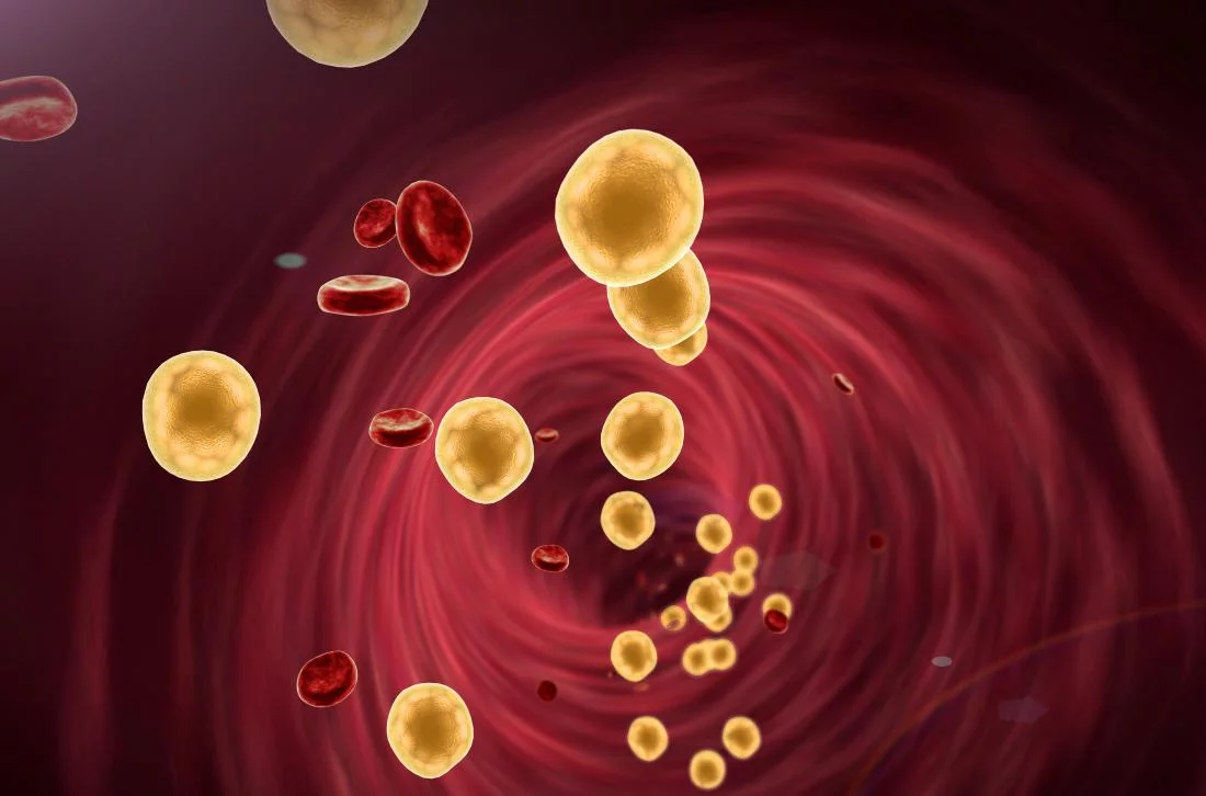 Dyslipidemia Types Causes Symptoms Treatment Explained