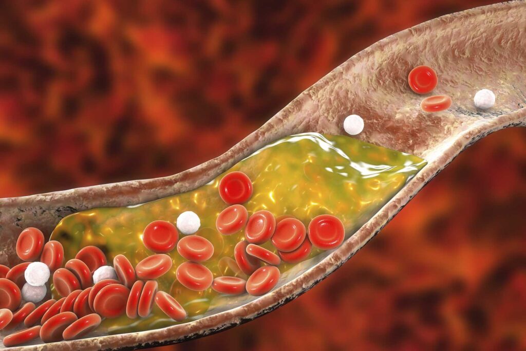 Hdl Vs Ldl Cholesterol Differences Ratios Ranges Effects 4223