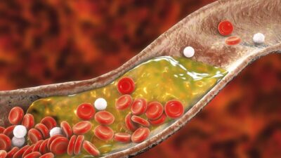HDL vs LDL Cholesterol: Differences, Ratios, Ranges, Effects