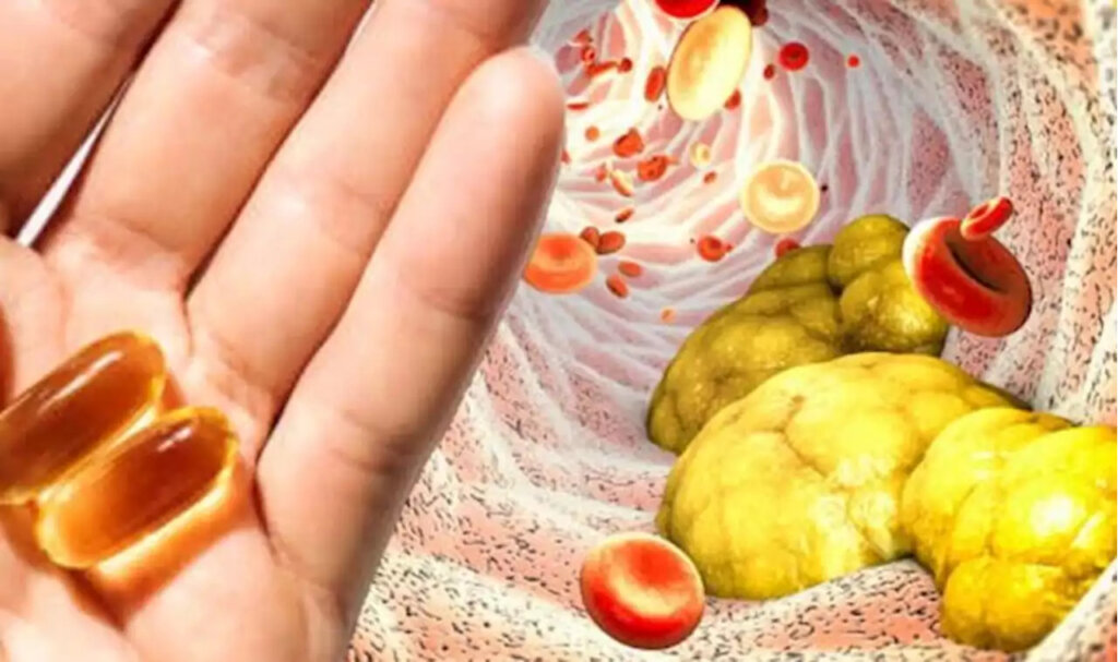 Omega3 and Cholesterol Does Omega3 Reduce cholesterol?