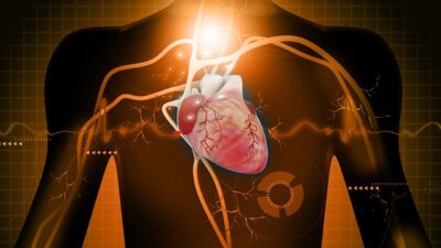 Electrocardiogram (ECG or EKG) Procedure, Test and Results