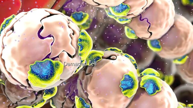 What is Inflammation? Types, Causes, Diagnosis, Treatment