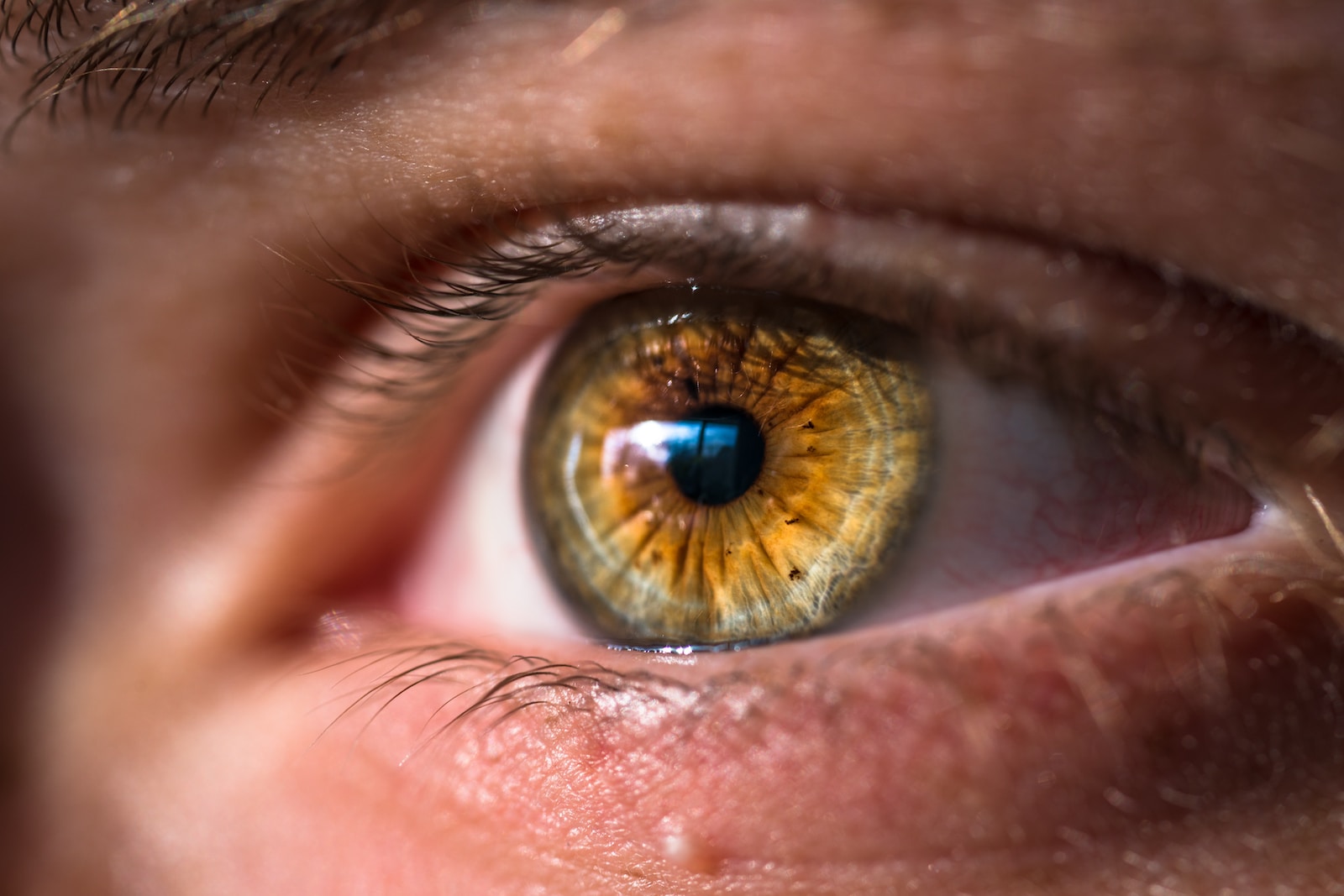 Who Treats Eye Infections