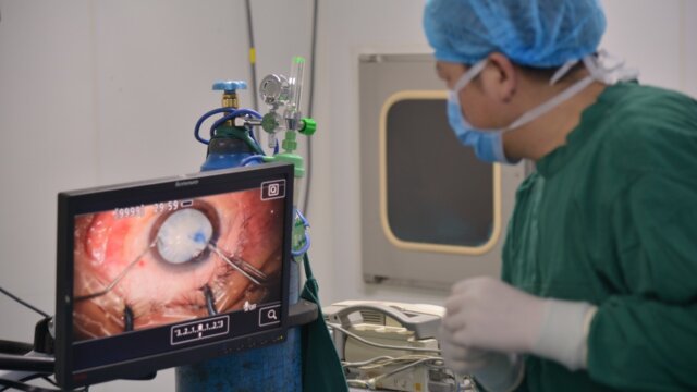 Exploring Cataract Surgery: Prevalence, Necessity, and Who Needs It